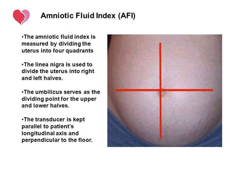 Amniotic Fluid Index Afi Medical Ultrasound Amniotic Fluid Sonography