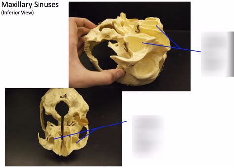 Maxillary Sinuses Diagram Quizlet