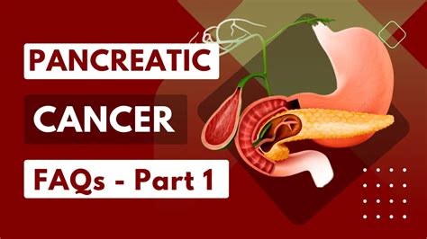 Pancreatic Cancer Frequently Asked Questions Part 1 Dr Harsh J Shah