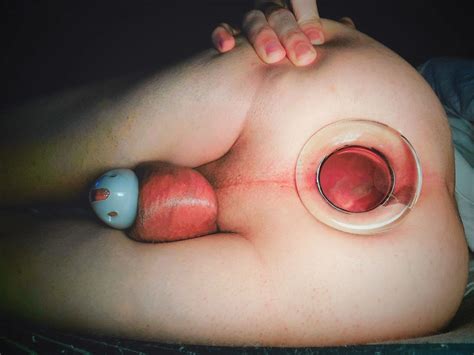 Femboy Ass 9 Nude Pics XHamster