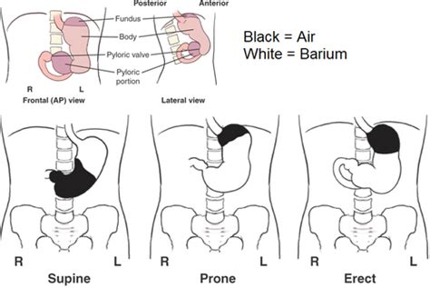 Chapter Biliary Tract And Upper Gastrointestinal System