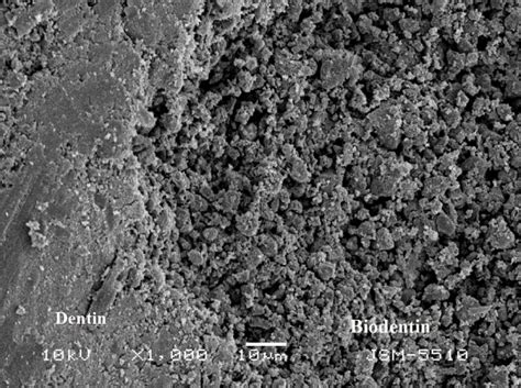 Marginal Adaptation Of Biodentine Sem ×1000 Magnification Download Scientific Diagram