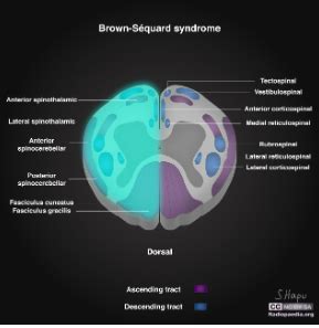 Clin Med Approach To The Neurologic Pt Flashcards Quizlet