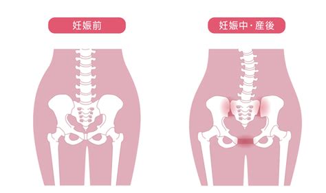 股関節が痛い原因は？病院か整体かどっちに行けばいいの？ 伊集院整骨院