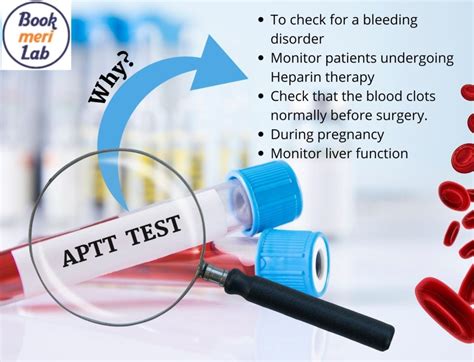 APTT Test Price, Purpose, Procedure & Results [2022]