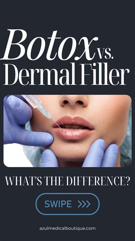 Everything You Need To Know About Botox Artofit