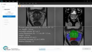 Latest Ai News And Announcements By Rsip Vision