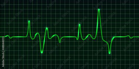 Heart Beat Pulse Monitor Green Electric Wave Signal Oscilloscope