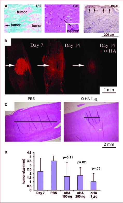 Effect Of O HA On Spinal Cord Glioma In The Rat A C6 Gliomas Cells