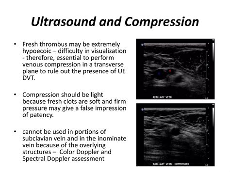 Venous Doppler upper limb | PPTX