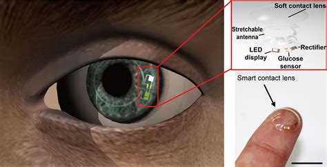 No Needles: Contact Lens Could Monitor Glucose for People with Diabetes ...