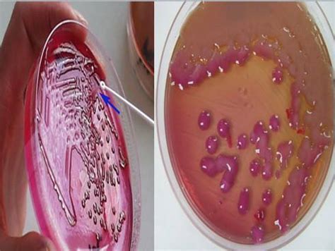 Alcohol Seizures Treatment: Antibiotic Treatment For Klebsiella ...