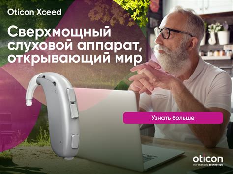 Слуховые аппараты Oticon Xceed - цены, купить в Москве и регионах в ...