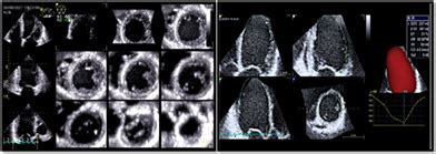 Multimodality Imaging Approach In Diagnosis And Therapy Of Various