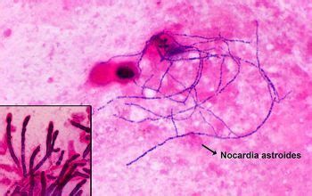 Nocardia Nova