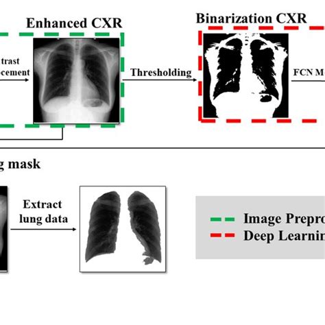 A Chest X Ray Cxr Image Histogram Is Divided Into The Two