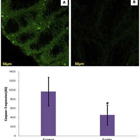 Representative Micrograph Of Ki 67 Expression In Healthy Colon Tissue Download Scientific