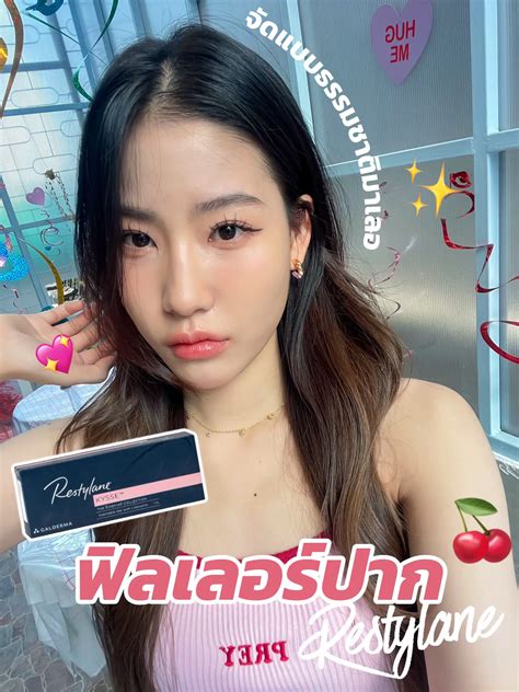 🍒 ฉีดปากครั้งแรกเลือก Restylane เลย 💕 แกลเลอรีที่โพสต์โดย ฮลม ชอบรีวิว🪄 Lemon8