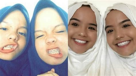 8 Potret The Connell Twins Dulu Berhijab Kini Umbar Aurat