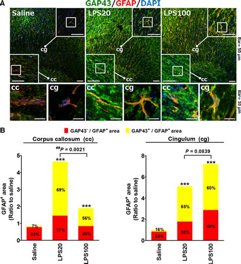 Lps Induced Gap Expression In Gfap Positive Astrocytes In Vivo A