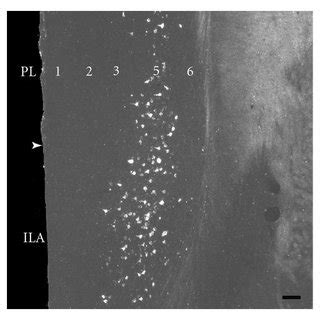 Dark Field Photomicrographs Showing A The Distribution Of