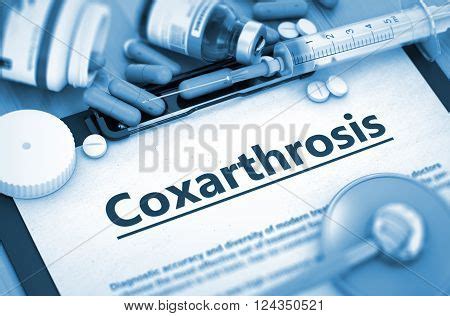 Coxarthrosis Images, Illustrations & Vectors (Free) - Bigstock