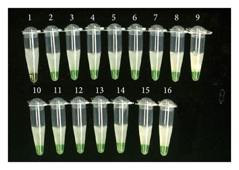 Specificity Of LAMP Detection For Different T Asahii Strains Lane 1