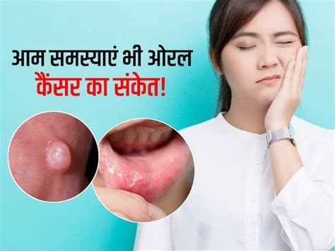 Oral Cancer भूलकर भी इग्नोर न करें मुंह के ये लक्षण ओरल कैंसर का हो