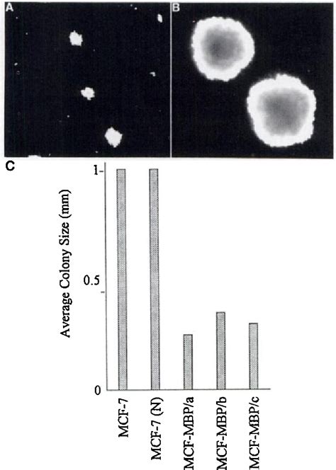 Pdf Human Breast Carcinoma Cells Transfected With The Gene Encoding A