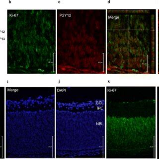 P Y And P Y Receptor Expression In Newborn Rat Retina A