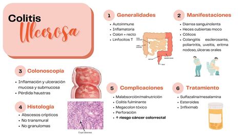 Colitis Ulcerosa UDocz