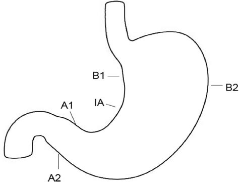 A Schematic Illustration Of Gastric Biopsies Carried Out In Present Download Scientific Diagram