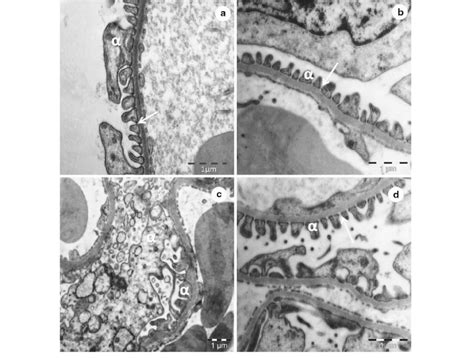 Transmission Electron Micrograph Of A Glomerulus In The Glomerular