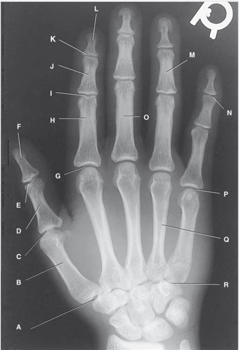 Right hand anatomy Diagram | Quizlet