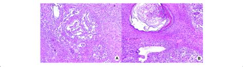 Hematoxylin And Eosin He Staining Of Testis Intra Tubular Germ Cell