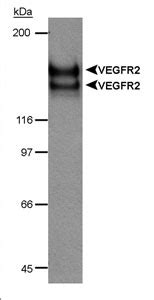 Anti KDR VEGFR2 FLK1 Antibody Rabbit Anti Mouse Polyclonal WB LSBio