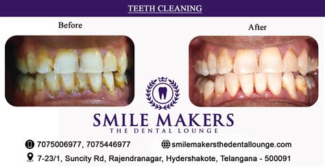 Dental Clinic In Suncity Hyderabad On Tumblr