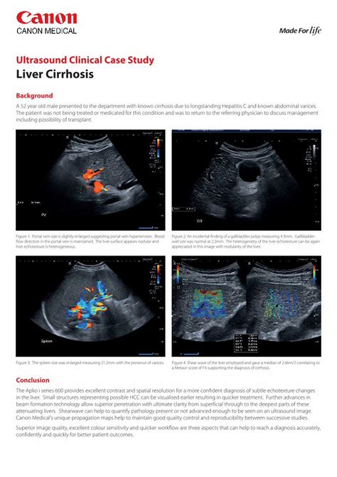 (PDF) Ultrasound Clinical Case Study Liver Cirrhosis · Ultrasound ...