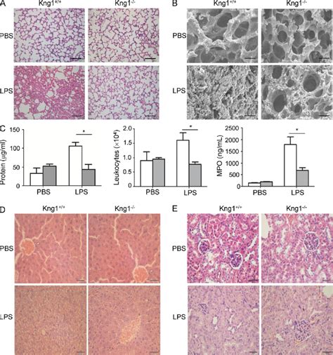 Hk Deficiency Ameliorates Lps Induced Multiple Organ Injury A And B