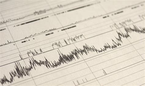 When to Get a Polysomnography vs a Home Sleep Test – ApneaMed