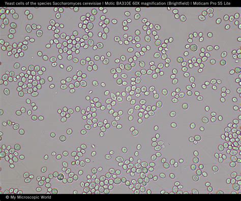 Saccharomyces Cerevisiae Under Light Microscope