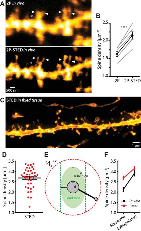 Chronic P Sted Imaging Reveals High Turnover Of Dendritic Spines In