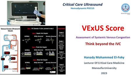 Vexus Score How To Assess Organ Congestion Youtube