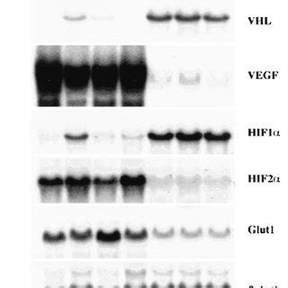 Northern Blot Analysis Of Total Rna From Vhl Deficient Cell Line Rcc