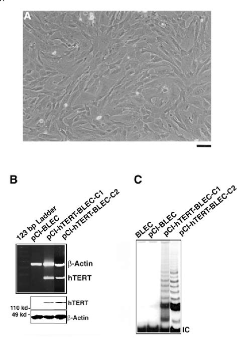 Figure 1 from Human Telomerase Reverse Transcriptase Immortalizes ...