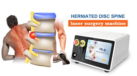 News How Is Laser Used In Pldd Percutaneous Laser Disc Decompression