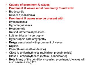 U WAVE IN ECG AND ITS ABNORMALITIES IN ECG | PPT