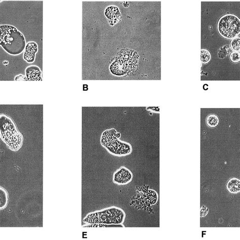 Phase Contrast Microscopy Showing The Effect Of Treatment For 16 H With Download Scientific