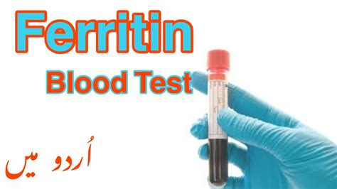 Ferritin Test In Urdu Ferritin Level Blood Test Purpose Procedure