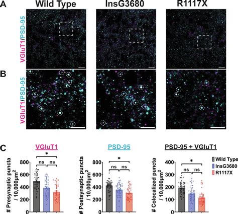 Shank Mutations Associated With Autism And Schizophrenia Lead To